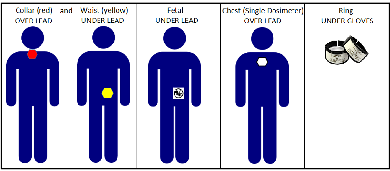 Dosimeter placement with lead apron shown. When issued two dosimeters, the collar and waist badges must be worn in the correct locations.  When issued a single dosimeter, it is worn at the collar. Fetal badges are worn at waist level under the lead apron.